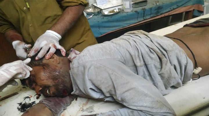 కాళేశ్వరం ప్రాజెక్టు లో అపశృతి