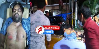 అపస్మారక స్థితిలో హీరో సాయిధరమ్ తేజ్