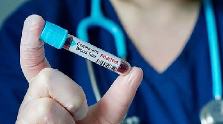 తెలంగాణలో కరోనా రికవరీ రేటు 94.13%