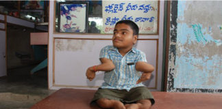 ఫ్లోరైడ్ పై అంశాల స్వామిది అలుపెరుగని పోరు